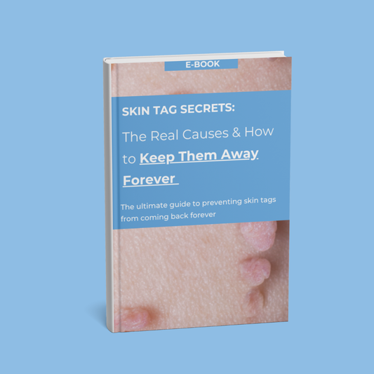Ebook