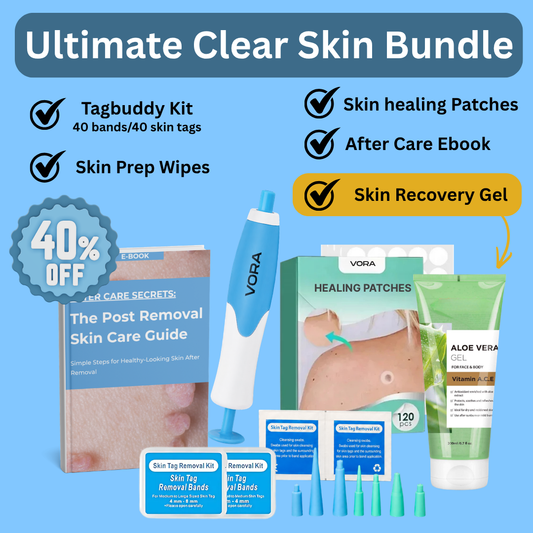 TagBuddy Kit - No More Skin Tags
